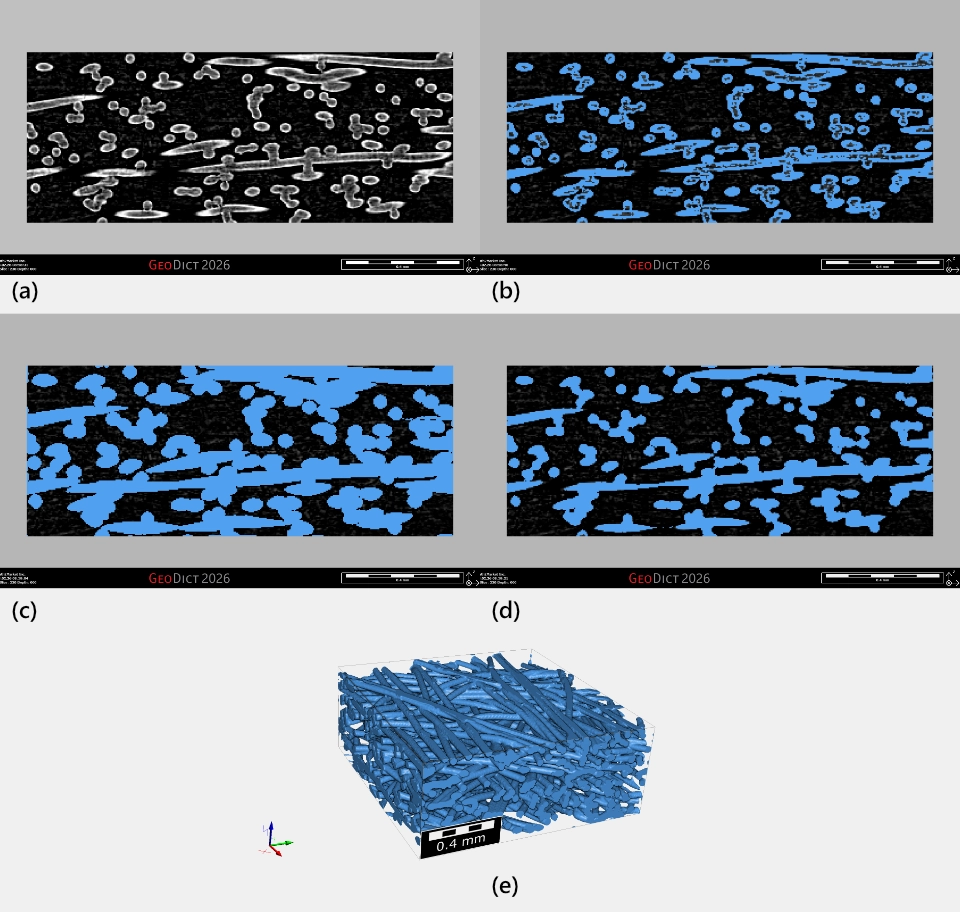 Beispiel für morphologische Operationen zur Verbesserung der Segmentierung bei einem Scan von Fasern. In (a) zeigt das ursprüngliche Graustufenbild, dass die Fasern in ihrer Mitte eine geringere Helligkeit aufweisen, (b) zeigt die Schwellenwertsegmentierung mit unzureichender Kennzeichnung in der Mitte der Fasern, (c) zeigt eine auf die Segmentierung angewendete Dilatationsfunktion, um die Mitten auszufüllen, und (d) eine Erosionsfunktion, um die ursprünglichen Fasergrenzen auf der Segmentierung wiederherzustellen. In (e) wird das Endergebnis in 3D mit gefüllten Fasern gezeigt.