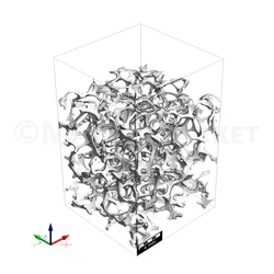 Segmented CT scan at 35% compression.