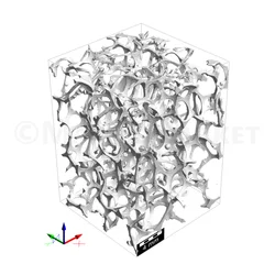 Segmented CT Scan before compression.